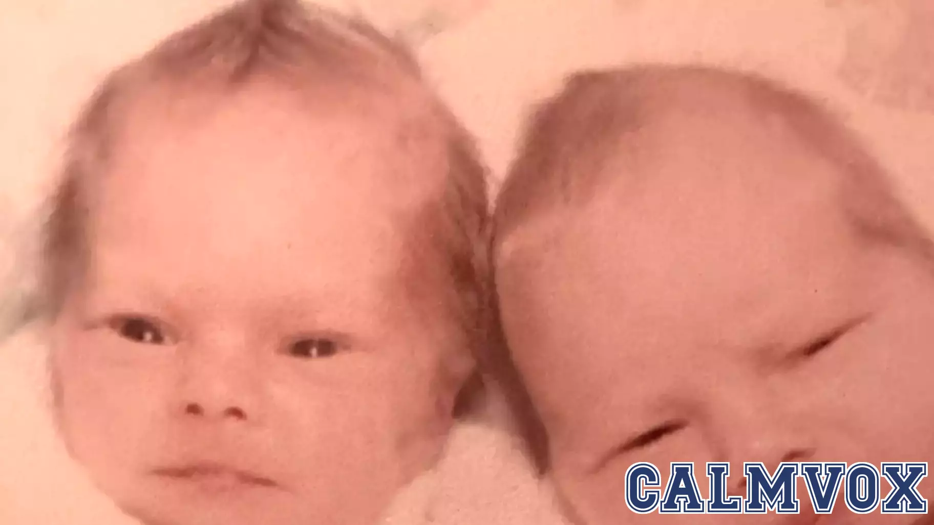 Understanding Turner Syndrome Through Twin Studies