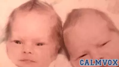 Understanding Turner Syndrome Through Twin Studies